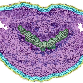 EBER ISH EBER ISHcells 274x274